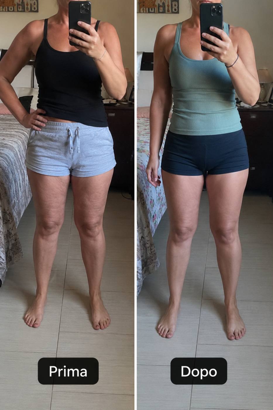 Prima e dopo Drenéa — cellulite e gambe gonfie