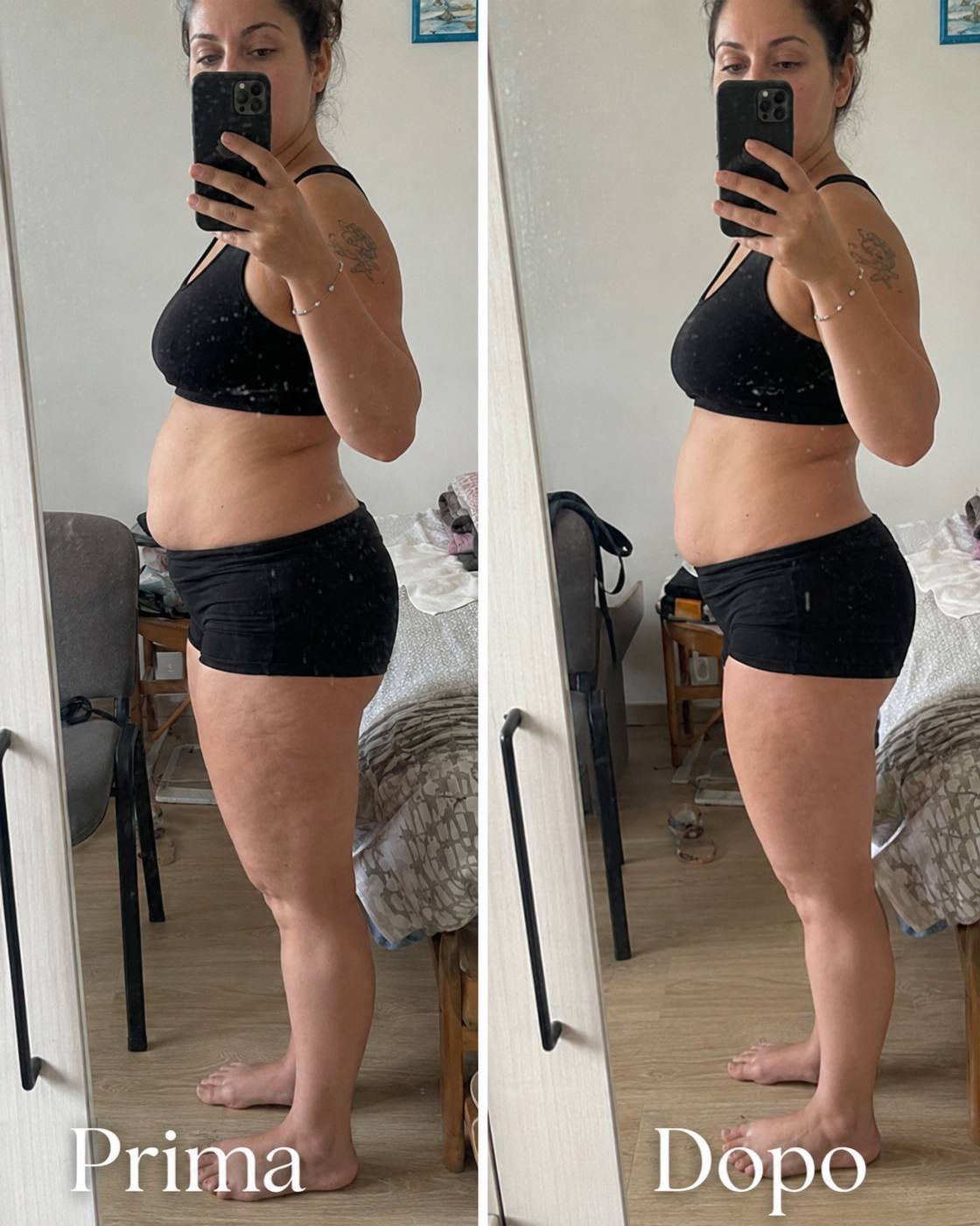 Prima e dopo Drenéa — cellulite e gambe gonfie