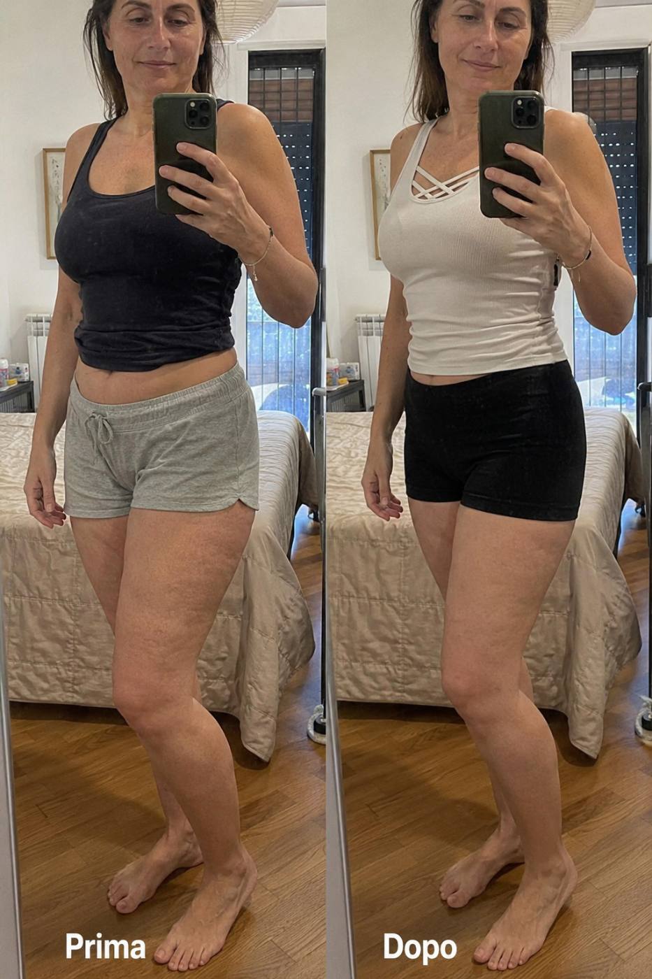 Prima e dopo Drenéa — cellulite e gambe gonfie
