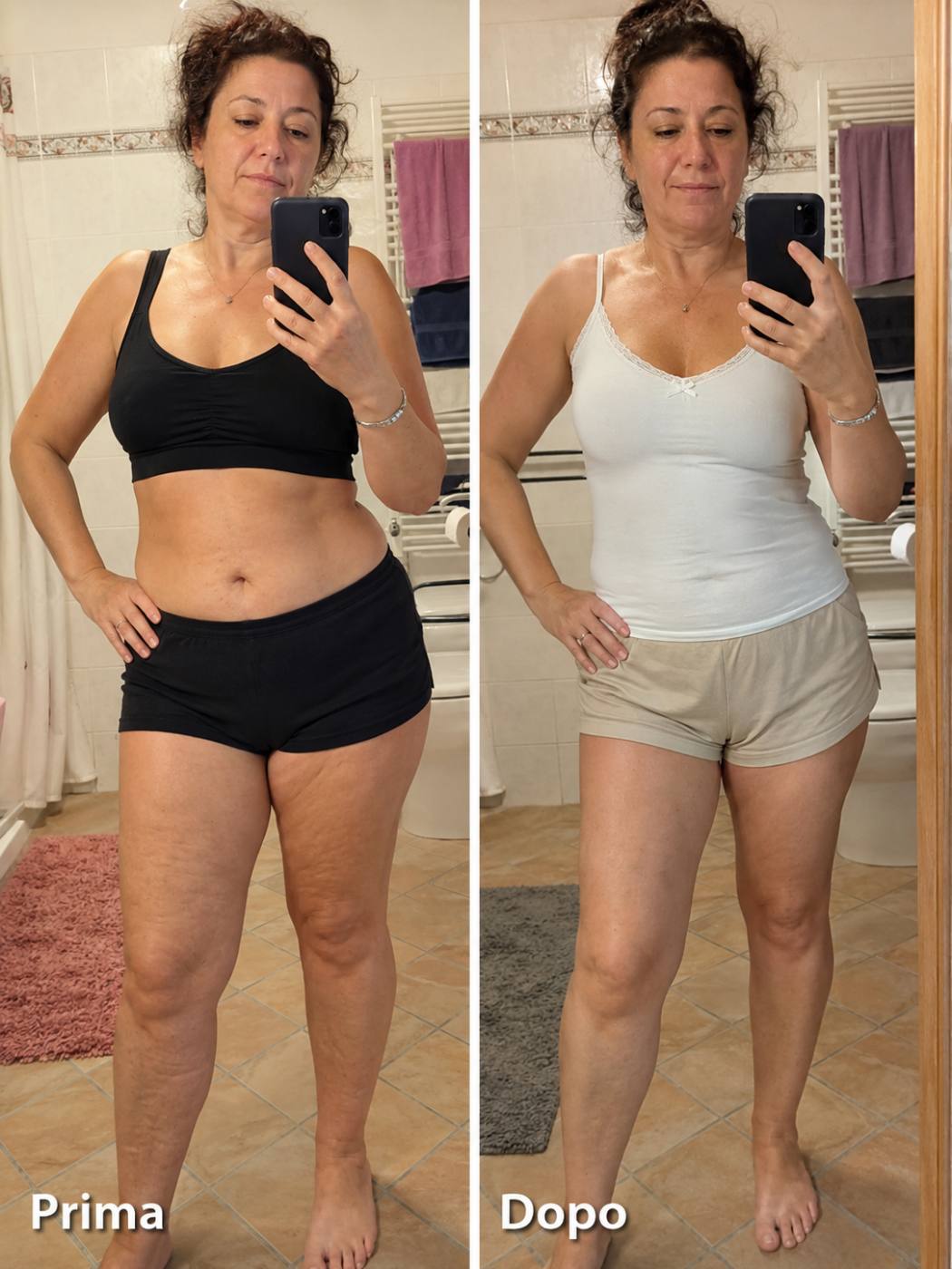 Prima e dopo Drenéa — cellulite e gambe gonfie